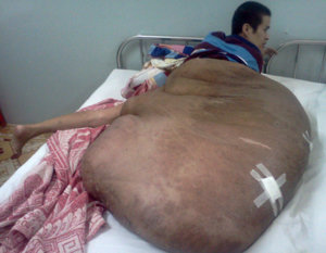 buu 90kilo2.jpg